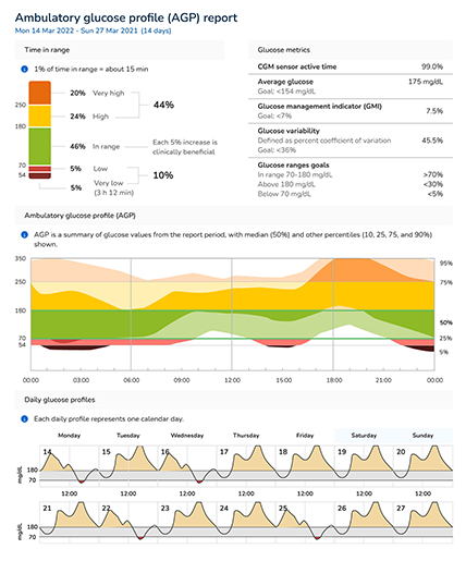 The Ambulatory glucose profile report displaying time in range, CGM active time, average glucose indicator, glucose variability and ranges goals.