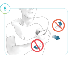 Illustration of Step 5:  The direction to remove the applicator from the application site.