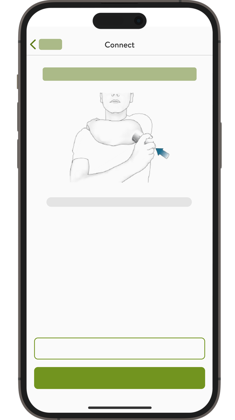 mySugr  apps’ Pairing apply sensor screen.